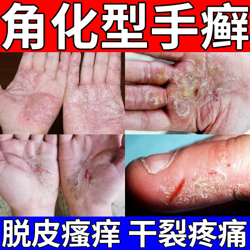 [福元]尿素维e乳膏1%15%*50g*1支/盒