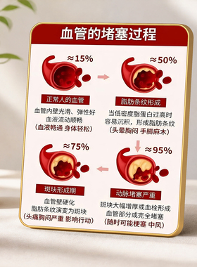 血管堵塞进程科普门店摆件