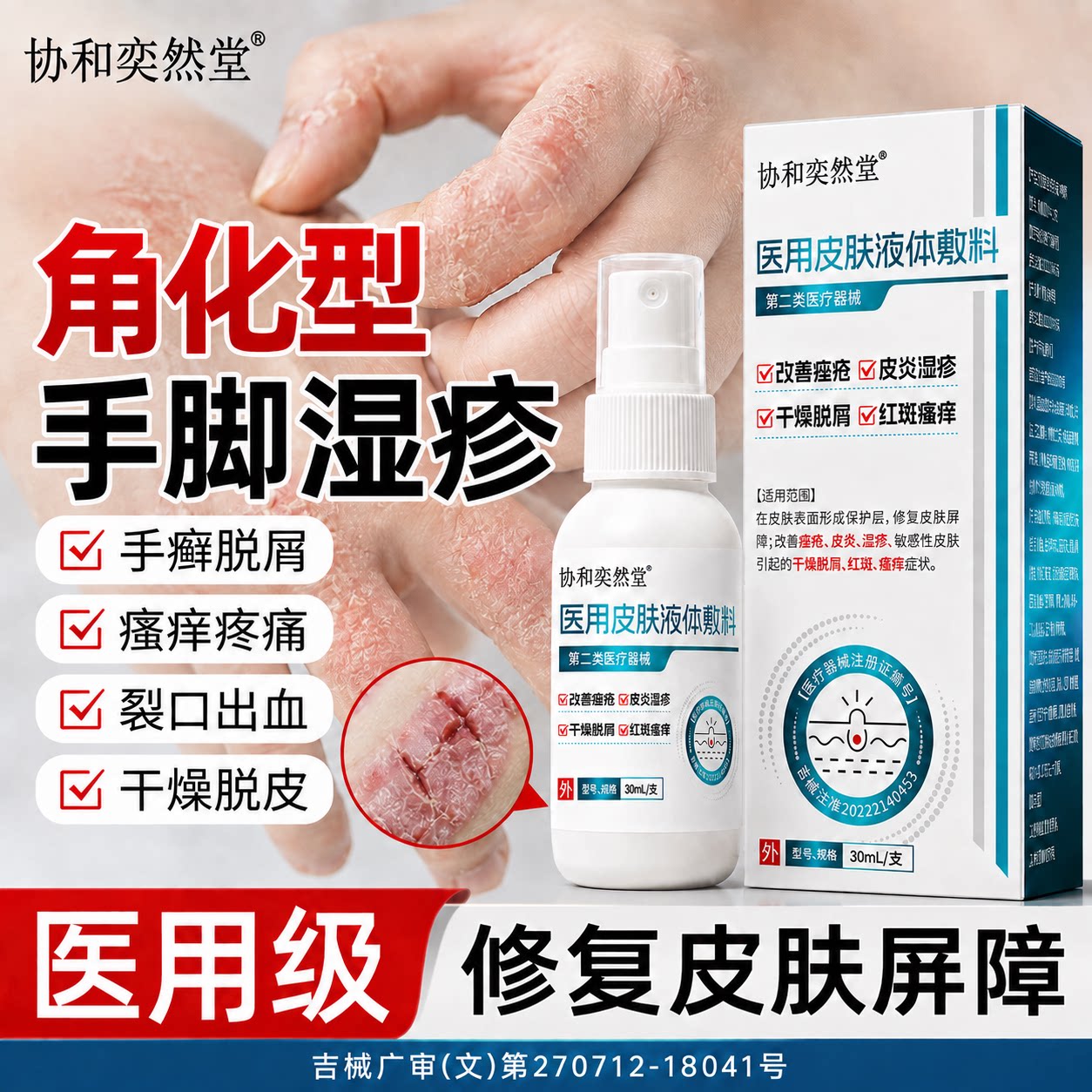角化型湿疹痤疮顽固皮炎干燥脱屑红斑瘙痒止痒皮肤干裂液体敷料