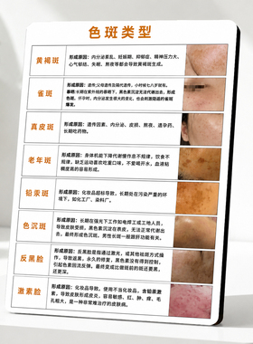 色斑成因科普店用摆件提升成交