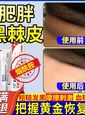 肥胖儿童小孩黑棘皮病黑刺皮颈黑鸡皮脖子黑色素去除无激素CS