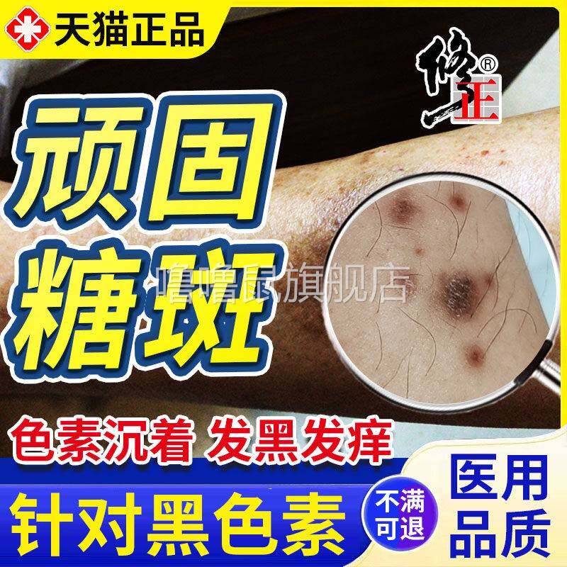 噜噜鼠正品糖尿病小腿黑斑去糖斑胫前皮肤色素沉着专用可搭烂足愈