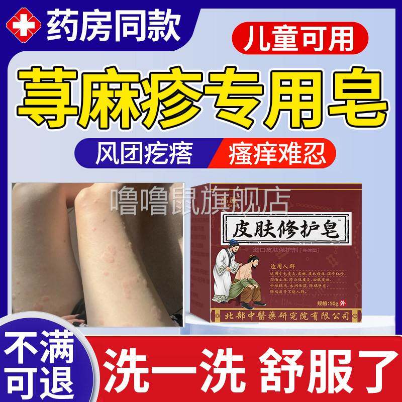 噜噜鼠正品寻荨麻疹专用皂肥皂沐浴露身体乳胆碱性儿童急慢性过敏