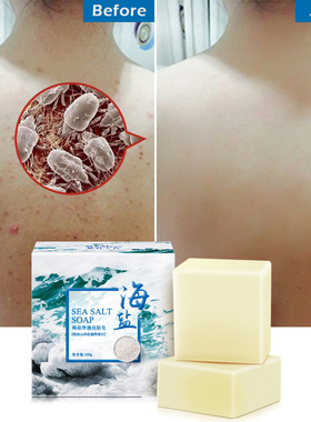 Sea Salt Cleaner oil control Anti acne treatment body Soap