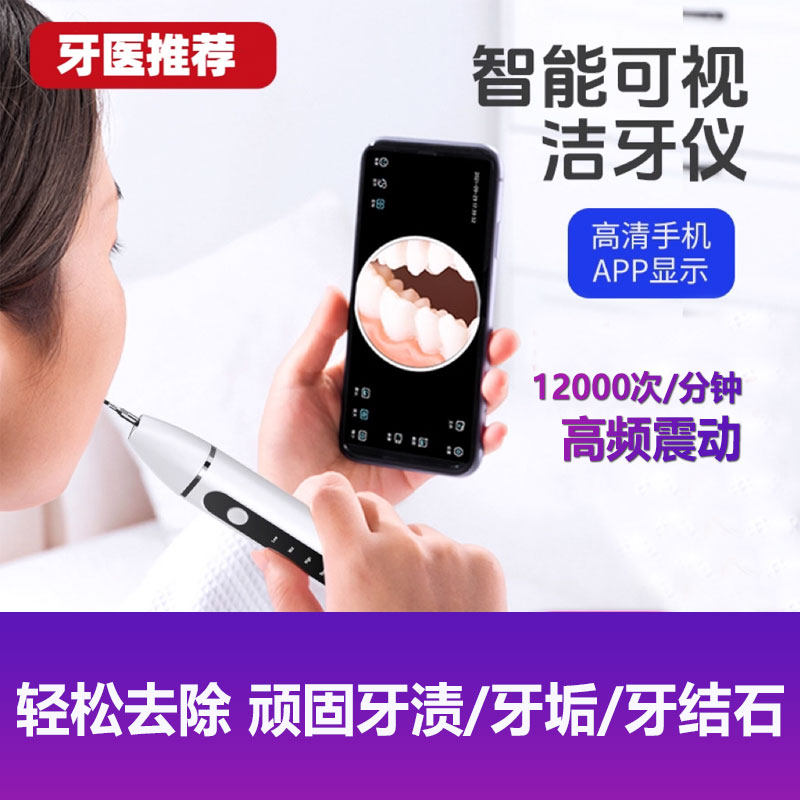 超声波智能可视洁牙器家用洗牙结石去除护理清除牙齿渍污垢美牙仪