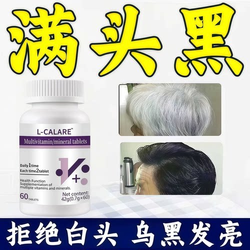 舒倍华维生素B内调白发脱发固发
