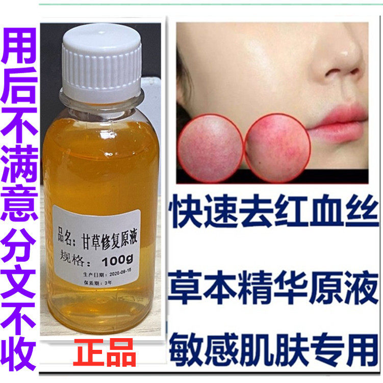 正品甘草修复原液 精华快速 退红止痒去红血丝敏感肌脸红100ml