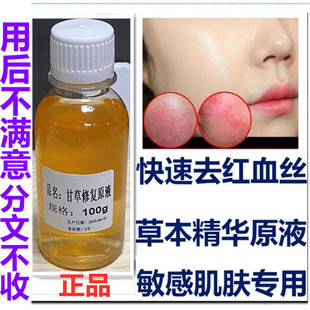 正品甘草修复原液 精华快速 退红止痒去红血丝敏感肌脸红100ml