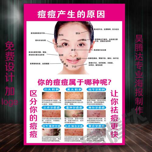 青春痘产生的原因痘痘的类型痤疮祛痘美容院装饰挂画海报皮肤管理