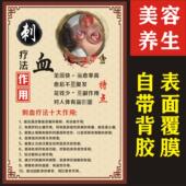 中医美容养生馆理疗店刺血疗法介绍挂图海报画展板墙贴海报背胶画