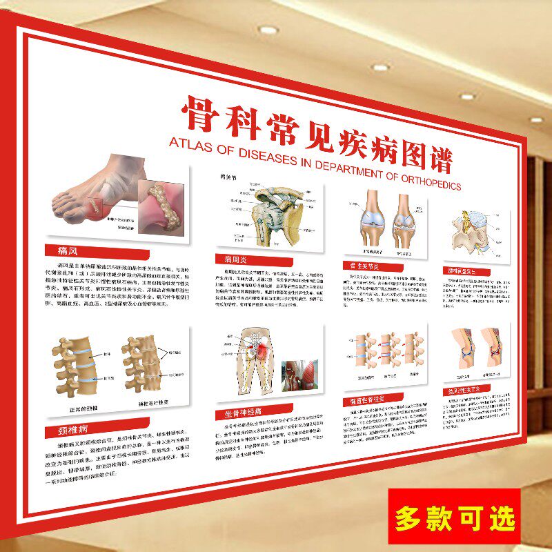 骨科常见疾病图谱 医学骨科挂图 人体骨骼结构展板 人体解剖海报