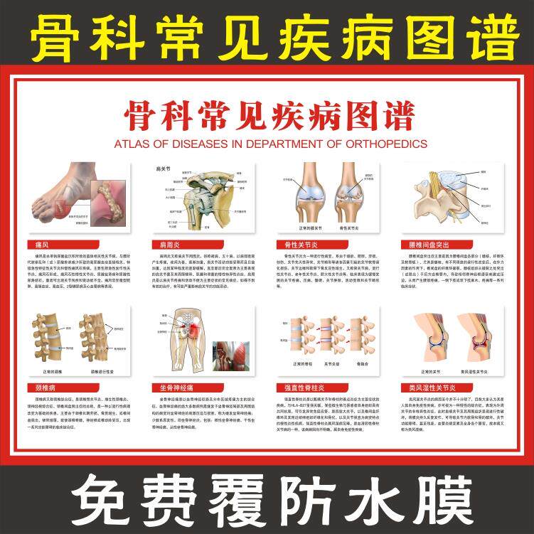 医院医学骨科挂图人体全身骨骼结构解剖图海报 骨科常见疾病图谱