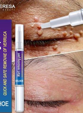 Warts Remover Liquid Antibacterial Ointment Wart Treatment C