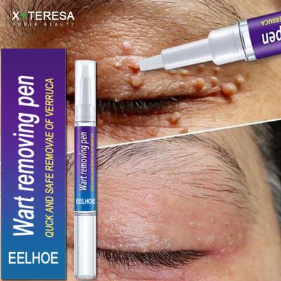 WartsRemovLiquidAnbac