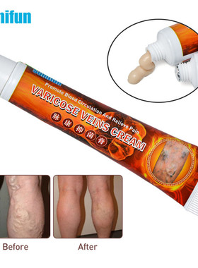 Sumifun 20g Treatment Varicose Veins Cream Varicosity Angiit