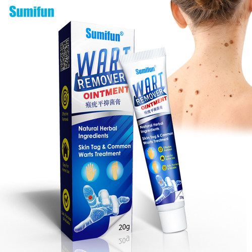 Sumifun20gWartsRemov