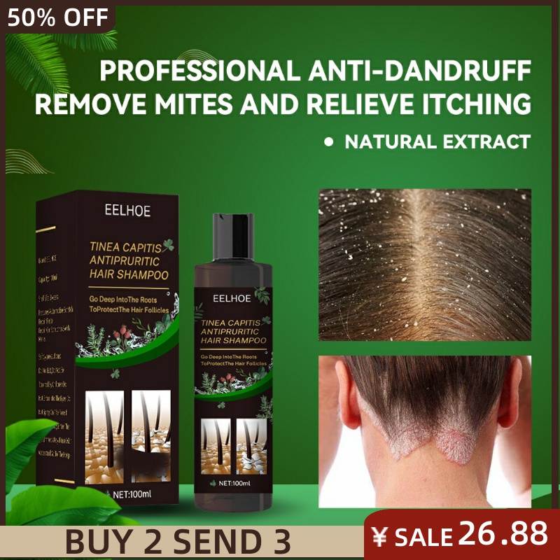 Shampoo Anti-Dandruff Treatment Itching and Flaking Psoriasi