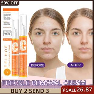 Removal Freckle pen VC霜面部淡化黑色素笔 care Vitamin skin