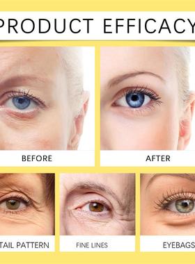 OUHOE Snail Serum Hyaluronic Acid Cream Salicylic  Centella