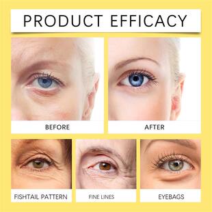 OUHOE Snail Serum Hyaluronic Acid Cream Salicylic  Centella