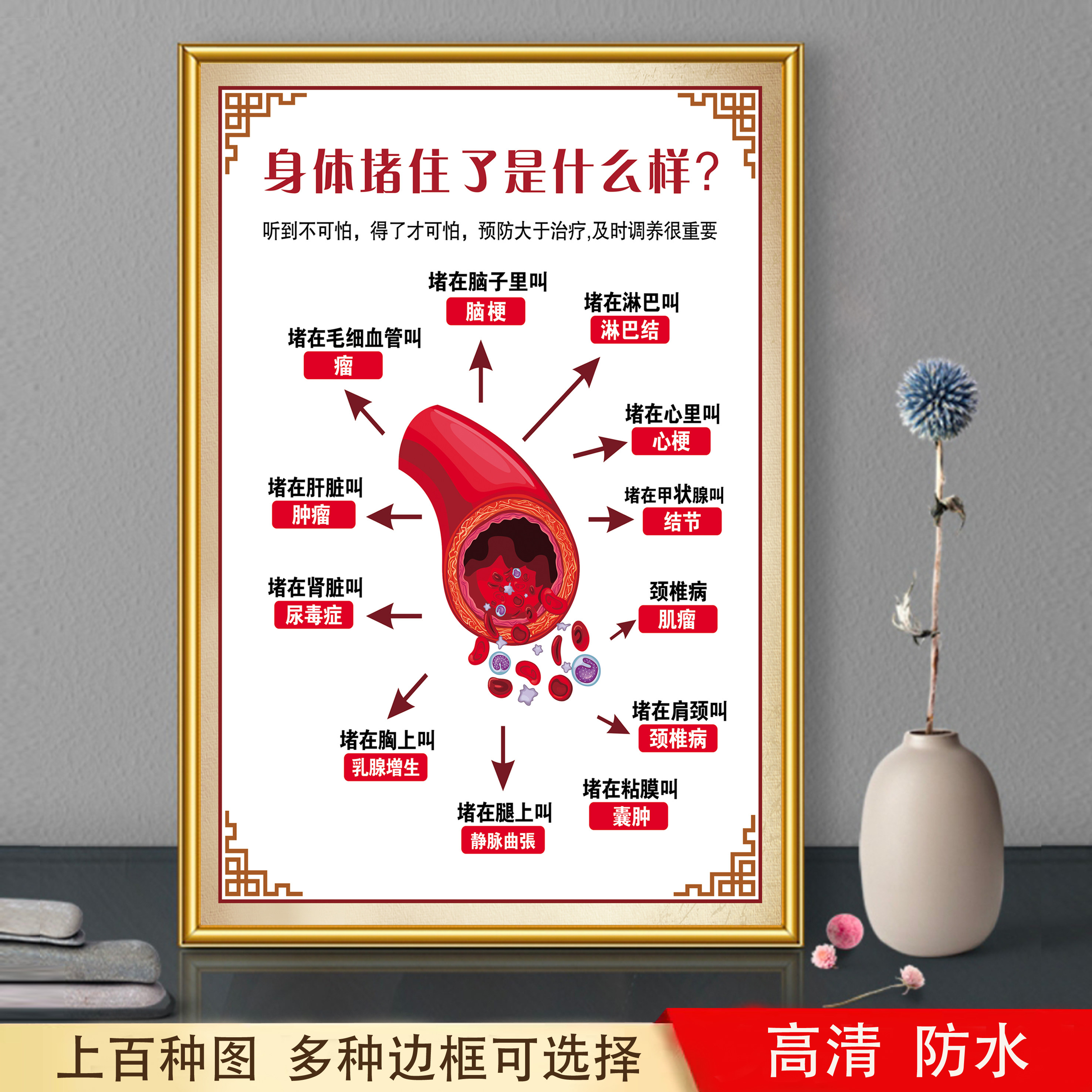 中医养生挂图经络淤堵装饰画海报图片