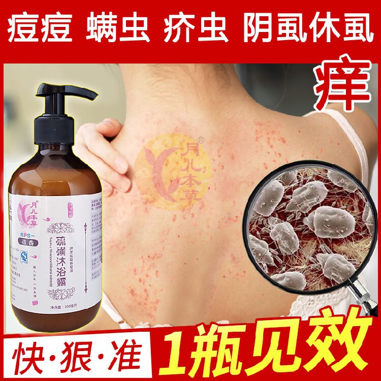 硫磺除螨沐浴硫磺皂液膏乳去螨疥虫驱体阴虱子祛豆控油抑菌皂去油