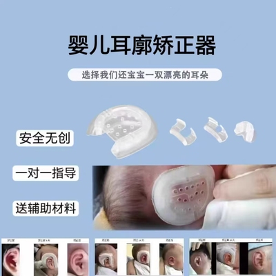医院同款耳廓矫正器婴儿硅胶耳夹