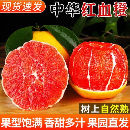 中华红血橙新鲜橙子当季水果红肉果冻橙秭归血橙手剥甜橙大果整箱
