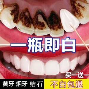 牙斑净祛牙黄正品牙班净去烟渍洗白去黄牙齿黑色污垢牙洁净一擦白