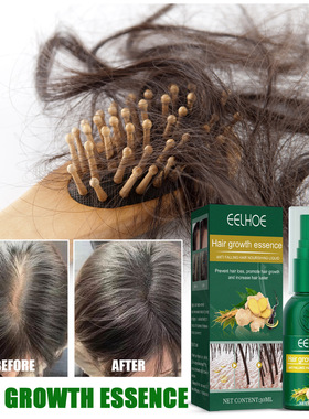 Ginger hair growth essential oil rapid hair growth beauty