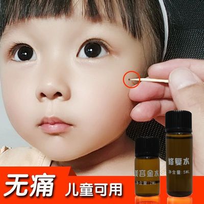 无痕美容金水医用晒斑雀斑祛斑老牌子修复正品美容院快速去除无痕