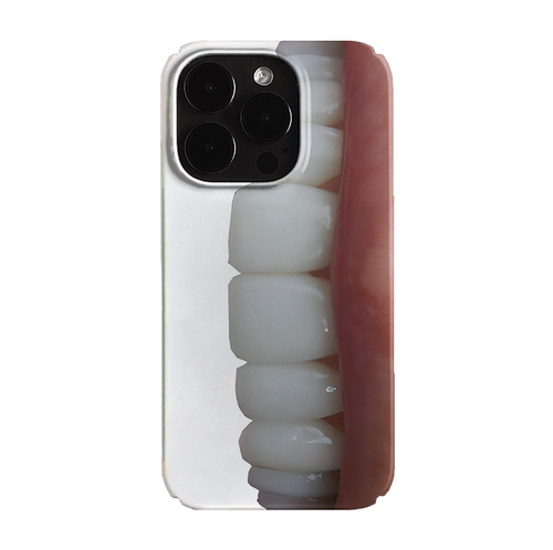 牙齿创意艺术潮流小众适用高级感卡通iPhone17pro+苹果16promax菲林手机壳新款14/15