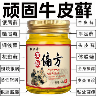 治疗癣股藓湿疹止痒根去皮肤瘙痒专用特傚手足癣药膏