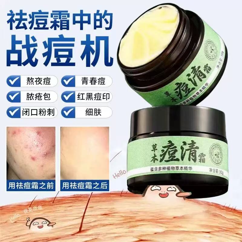草本祛痘药膏初中生青春期男孩