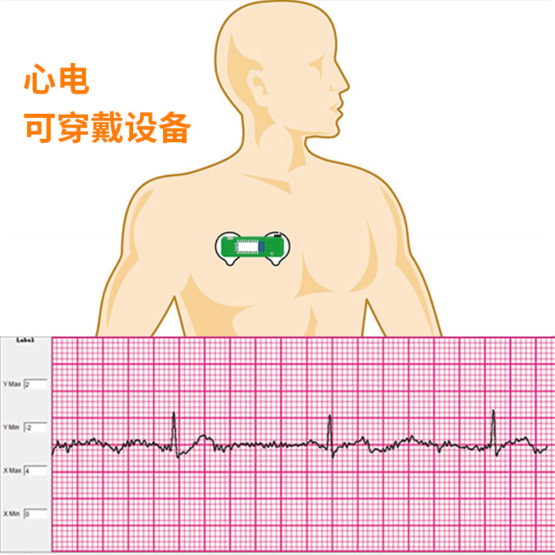 BMD1心01电传感器ECG模块心电图传感器套件心率HRV胸贴可穿戴设备 电子元器件市场 传感器 原图主图