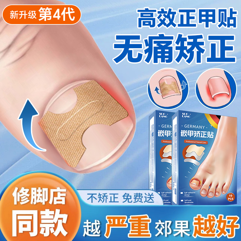 指甲矫正器甲沟嵌甲片专用隔离填充垫片脚趾甲往肉里长纠正甲贴炎