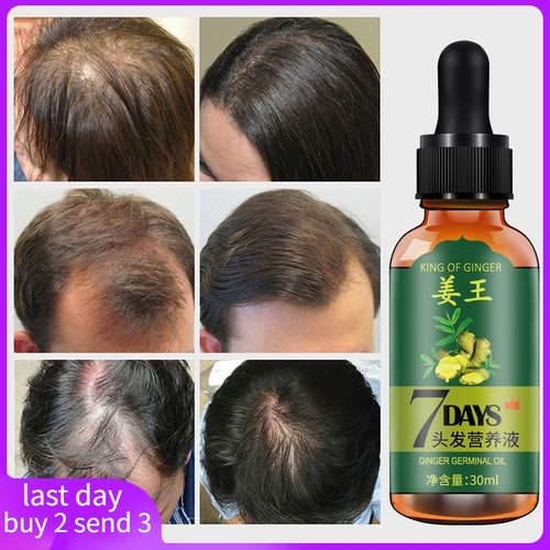 Hair Loss Treatment Ginger Growth Essence Oil老姜头发养护油