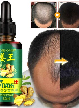 7 Days Powerful Hair Growth Products Essential Oil Beard