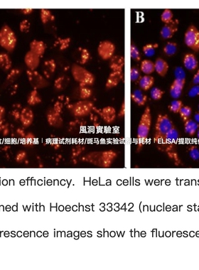 RFect小核酸转染试剂,转染siRNA小分子RNA,转染绝大多数贴壁细胞