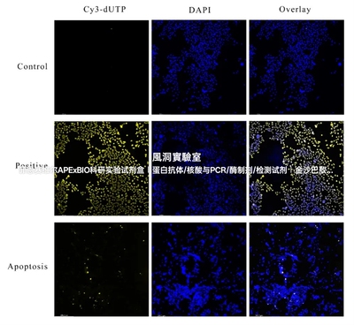 APExBIO一步式TUNEL Cy3细胞凋亡检测试剂盒高效检测组织细胞凋亡