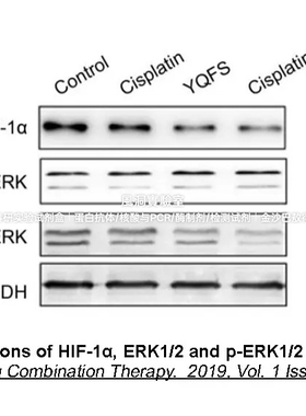 APExBIO即用型100X磷酸酶抑制剂混合浓缩原液1(溶DMSO)抑制磷酸酶