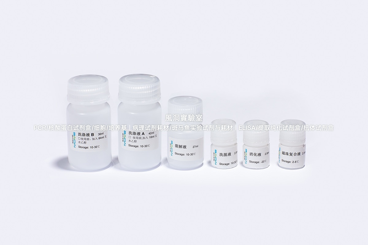 BIOG血浆(血清)核酸磁珠法提取试剂盒,可提取液体样本游离DNA/RNA