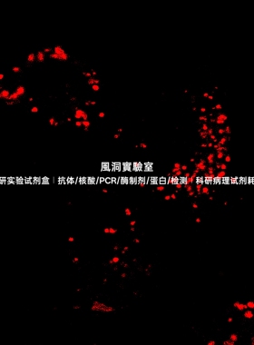 AIE溶酶体红色探针,专用靶向溶酶体迅速捕捉溶酶体形态和功能变化