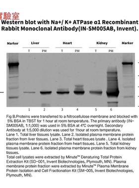 Invent®Na+/K+ATPase ɑ1重组兔单克隆抗体IN-SM005AB重组兔单抗