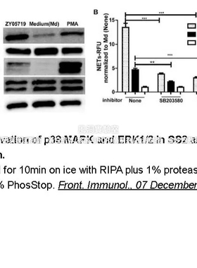 APExBIO蛋白酶抑制剂混合液100X(无EDTA溶DMSO)相当于Sigma P8849