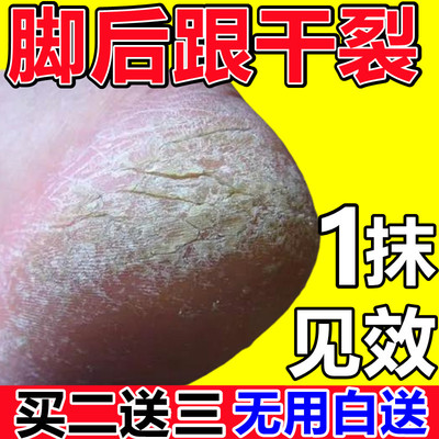 【买1送1】脚后跟干裂龟裂霜