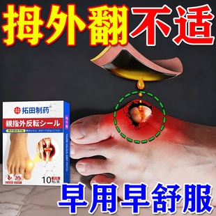 拇指膏贴大脚骨外翻贴拇指疼关痛节畸形外翻矫正器日本药贴