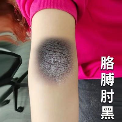 去脖子黑棘皮药膏脖子黑色素沉淀去除淡化深层清洁颈部美白霜a
