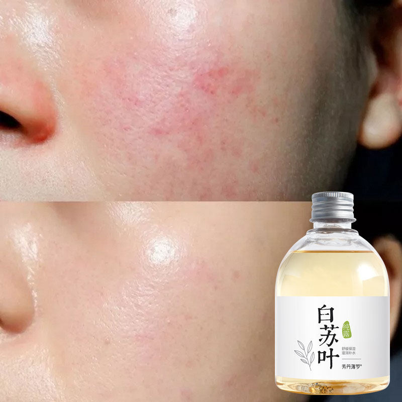 【屈臣氏卖爆 买2送1】淡化脸上红点红丝~不要大红脸远离高原红