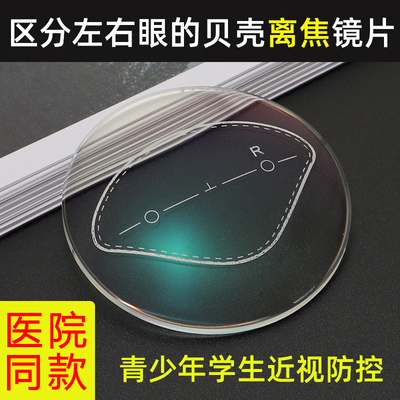 班格利离焦防控镜片送镜框一副